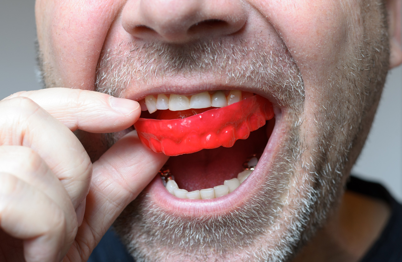 sports mouth guard in portadown northern ireland