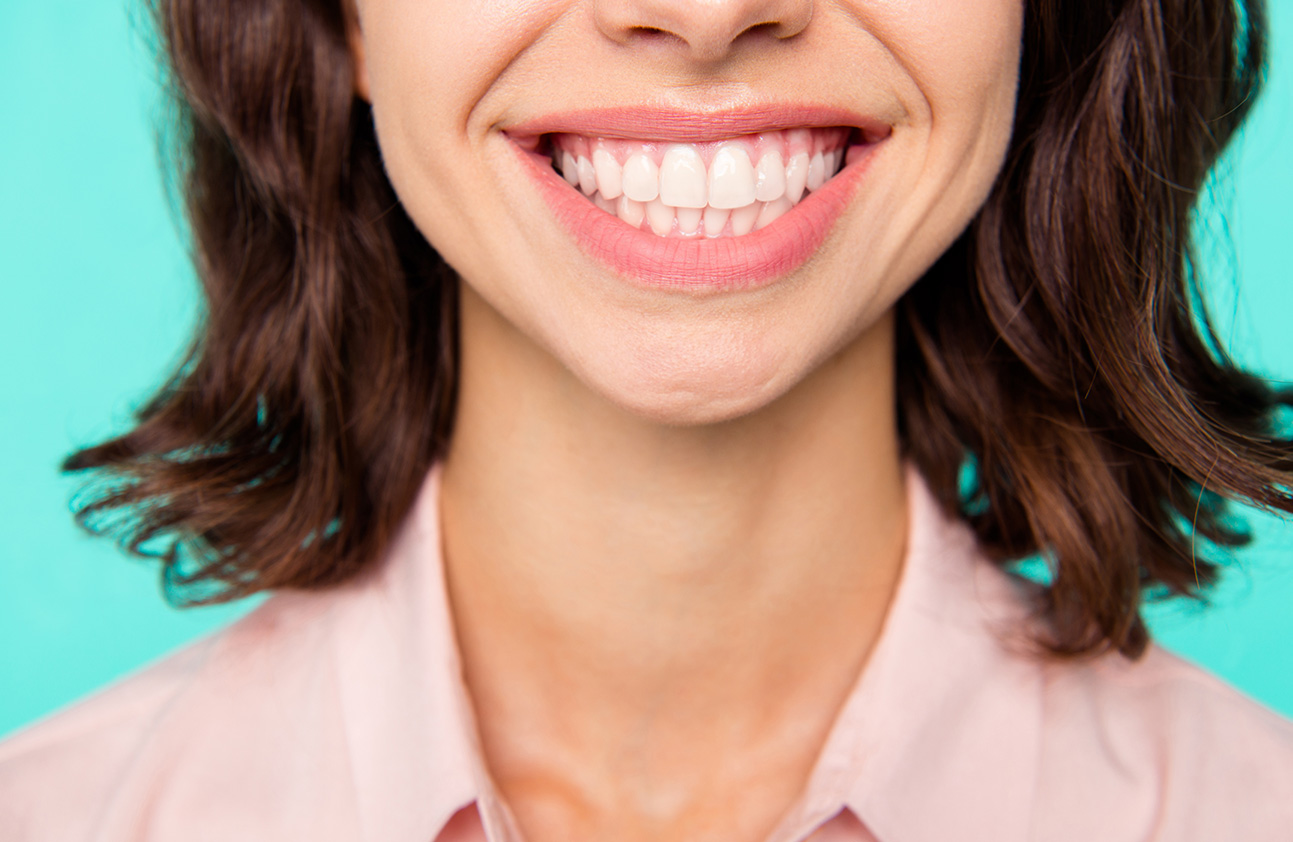 Dental Scale and Polish in Portadown Northern Ireland